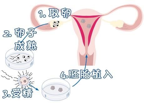 着床障害